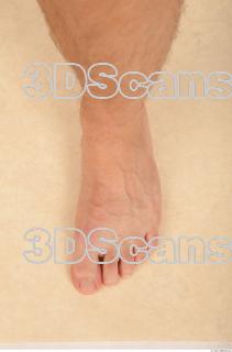 Photo reference of foot 0001